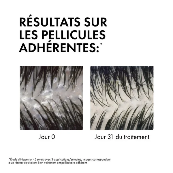 Anti-Pelliculaire Shampooing Traitant Pellicules et Démangeaisons Cheveux Normaux à Gras, Eco-recharge 390ml