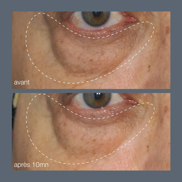 awaken peptide eye gel | contour des yeux anti poches aux peptides