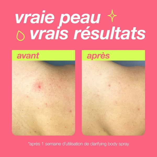 clarifying body spray | brume corporelle anti-imperfections purifiante