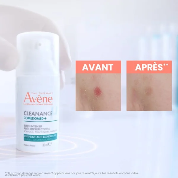 CLEANANCE COMEDOMED+ - Soin Intensif Anti-Imperfections - Visage - Peaux Grasses à Tendance Acnéique, 30ml