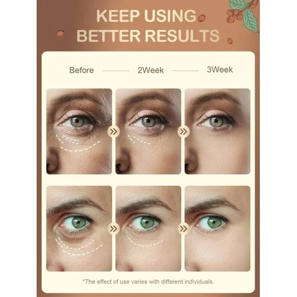 Contour des yeux gel pour les poches, cernes marrons, ridules, éclaircit 15ml
