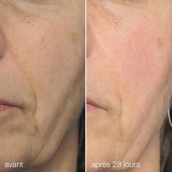 liquid peelfoliant | peeling professionel à domicile (30% aha + bha + pha)