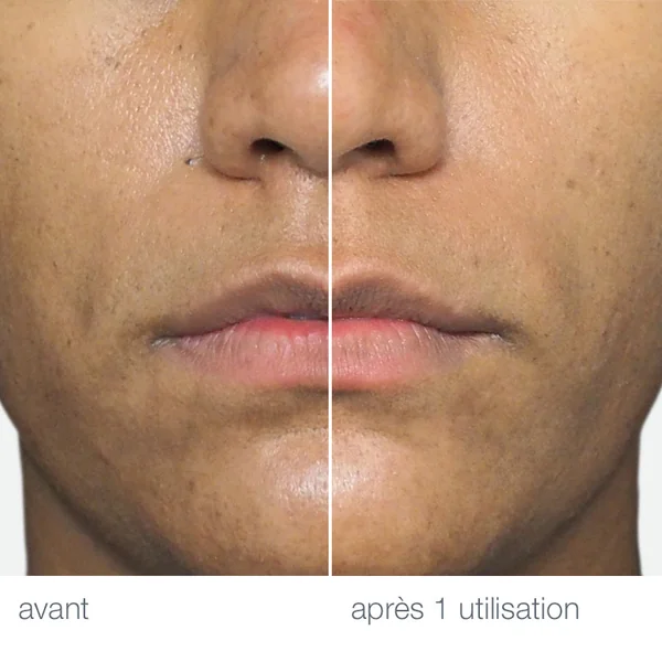 liquid peelfoliant | peeling professionel à domicile (30% aha + bha + pha)