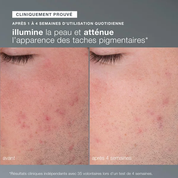 poudre exfoliante Daily Microfoliant | Exfoliant visage doux quotidien best seller