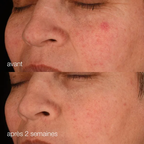 pro-collagen banking serum | sérum booster de collagène - Repulpe, illumine & hydrate
