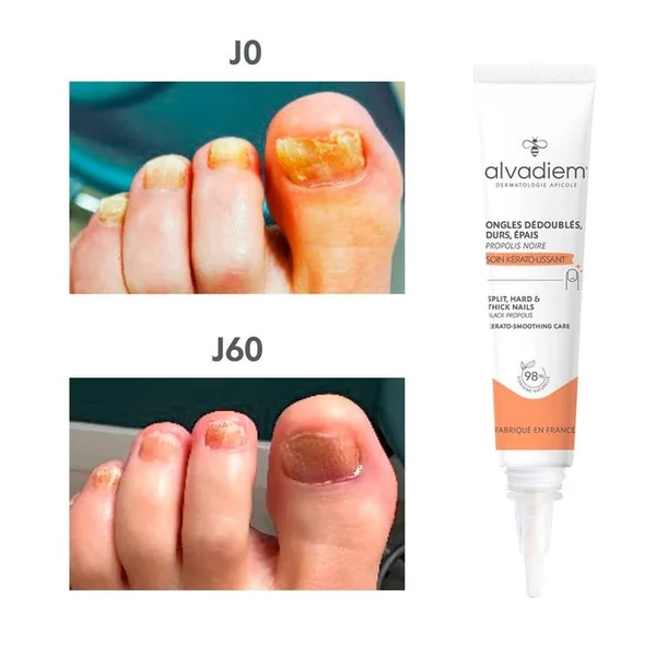 Soin Kerato-Lissant Ongles à la Propolis Noire - Ongles Durs, Epais, Dédoublés, 10ml