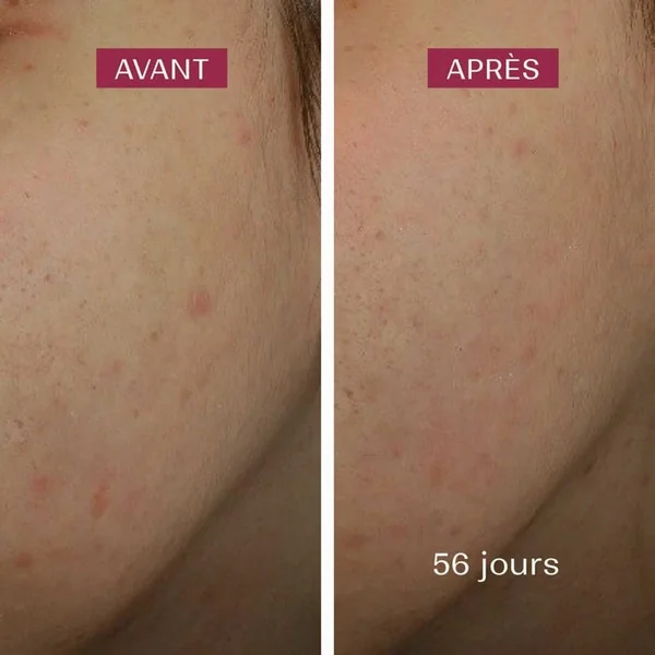 Sérum Anti-Taches Bio - Visage - Tous Types de Peaux, 30ml